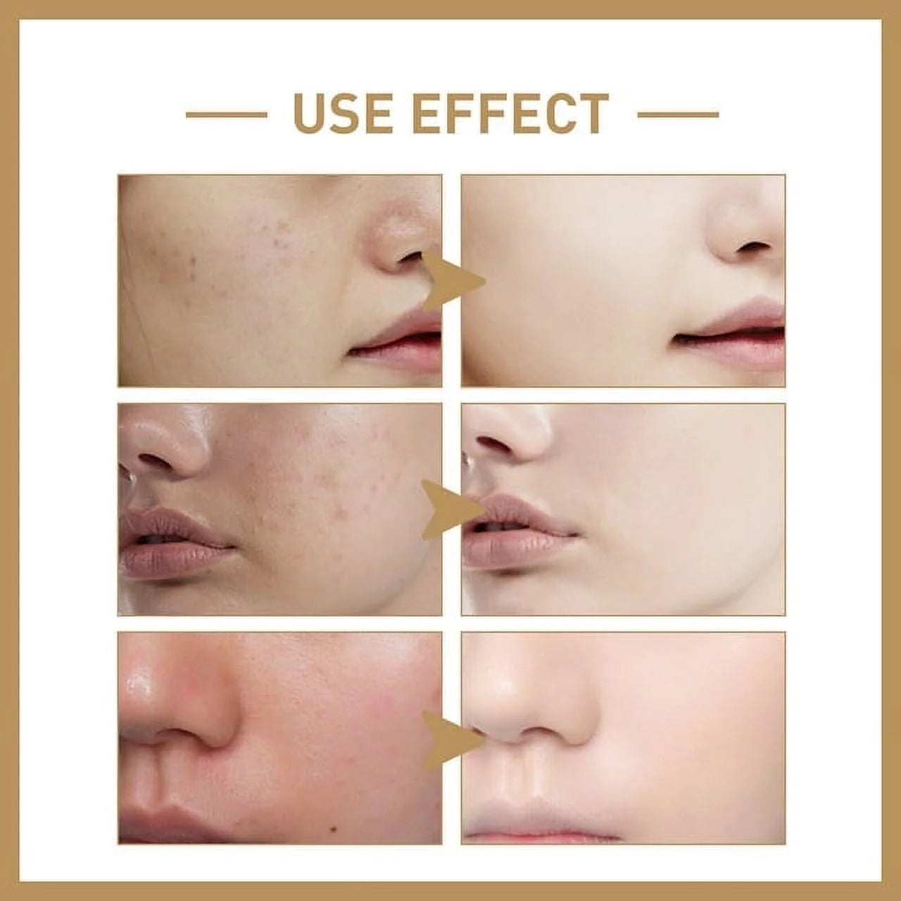 Rice Face Toner - Hydrating & Moisturizing