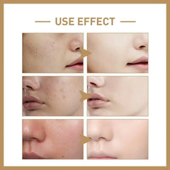 Rice Face Toner - Hydrating & Moisturizing